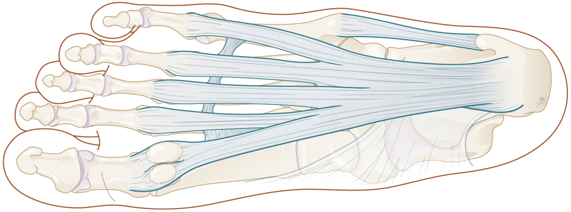 De officiële naam voor een hielspoor is fasciitis plantaris